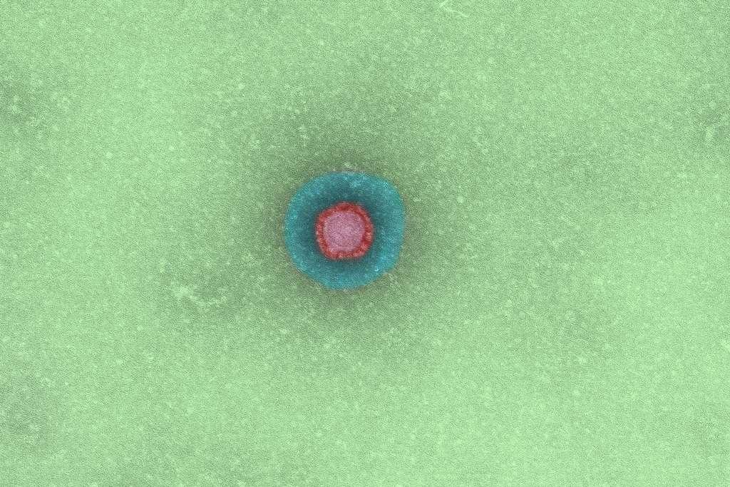 Le coronavirus Sars-CoV. © Institut Pasteur 